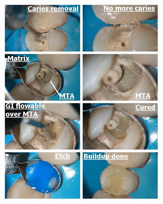 Resize of Premolar pg 3.jpg